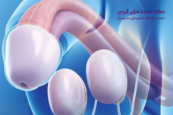 پروتز بیضه برای چه کسانی مناسب است؟